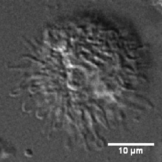 Differential interference contrast (DIC) microscopy of a human monocyte