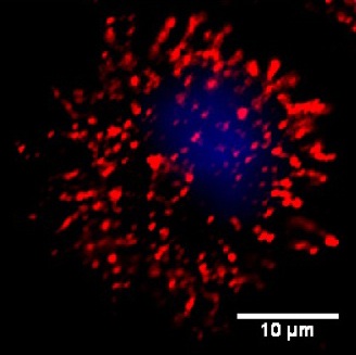 Integrin staining (red) on the surface of a human monocyte